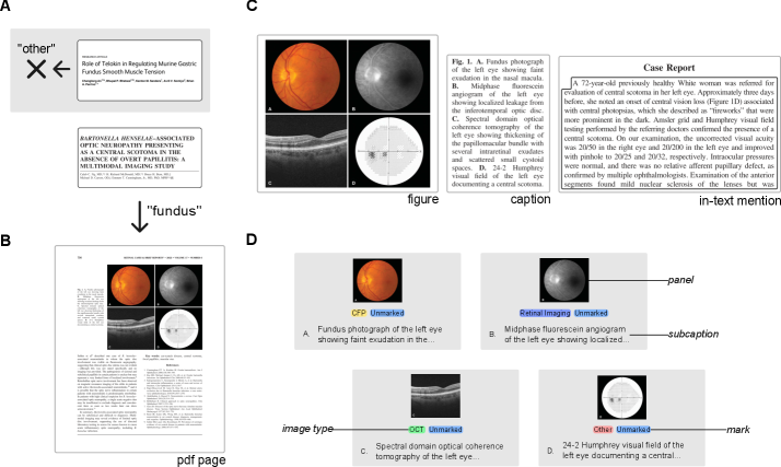 PubMed-Ophtha: An open resource for training ophthalmology vision-language models on scientific literature Figure 1