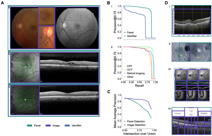 PubMed-Ophtha: An open resource for training ophthalmology vision-language models on scientific literature Figure 2