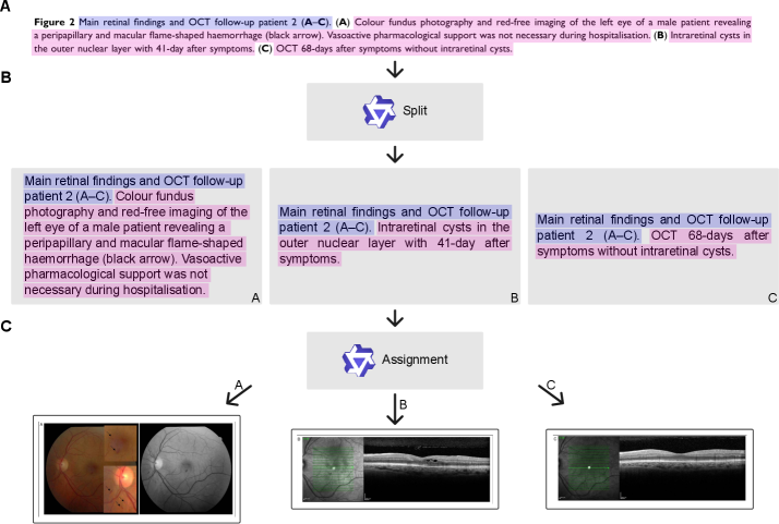 PubMed-Ophtha: An open resource for training ophthalmology vision-language models on scientific literature Figure 3
